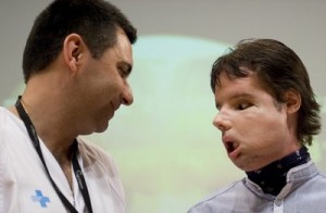 Spain Face Transplant Spain Face Transplant